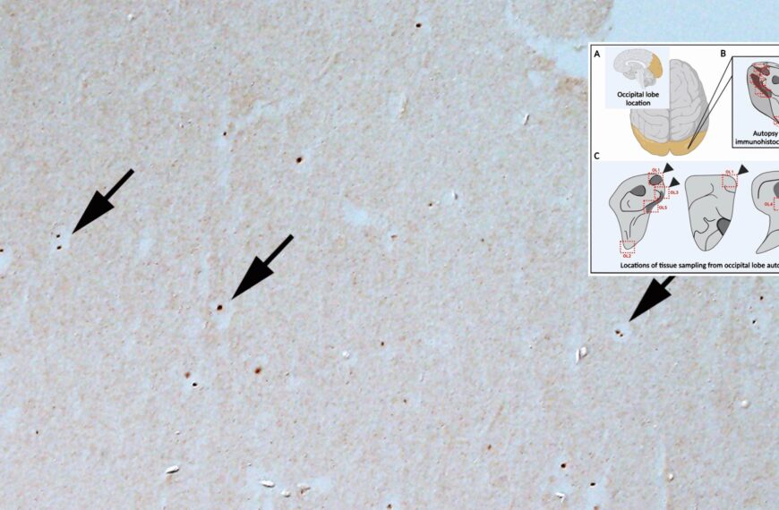 A figure of brain testing locations over top of a microscopic image of Borrelia.