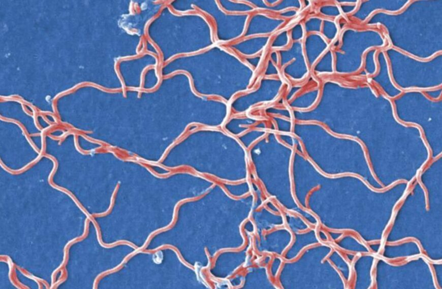 Scanning electron microscopic (SEM) image of Borrelia burgdorferi bacteria.