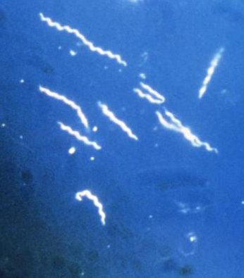 Borrelia burgdorferi, one of the species of bacteria that cause Lyme disease, magnified 400 times.